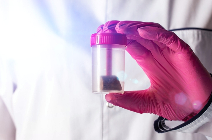Semen Analysis
