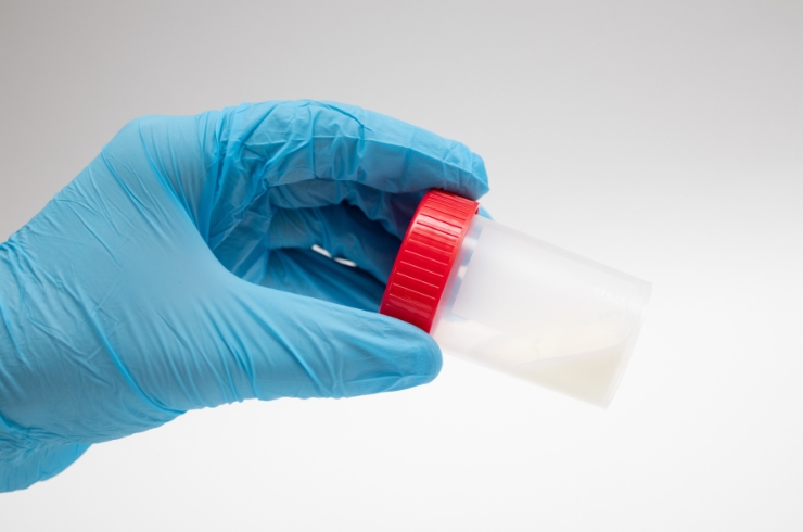 STOOL TESTS